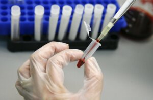 Дізнатися свій ВІЛ-статус. Безкоштовно та анонімно